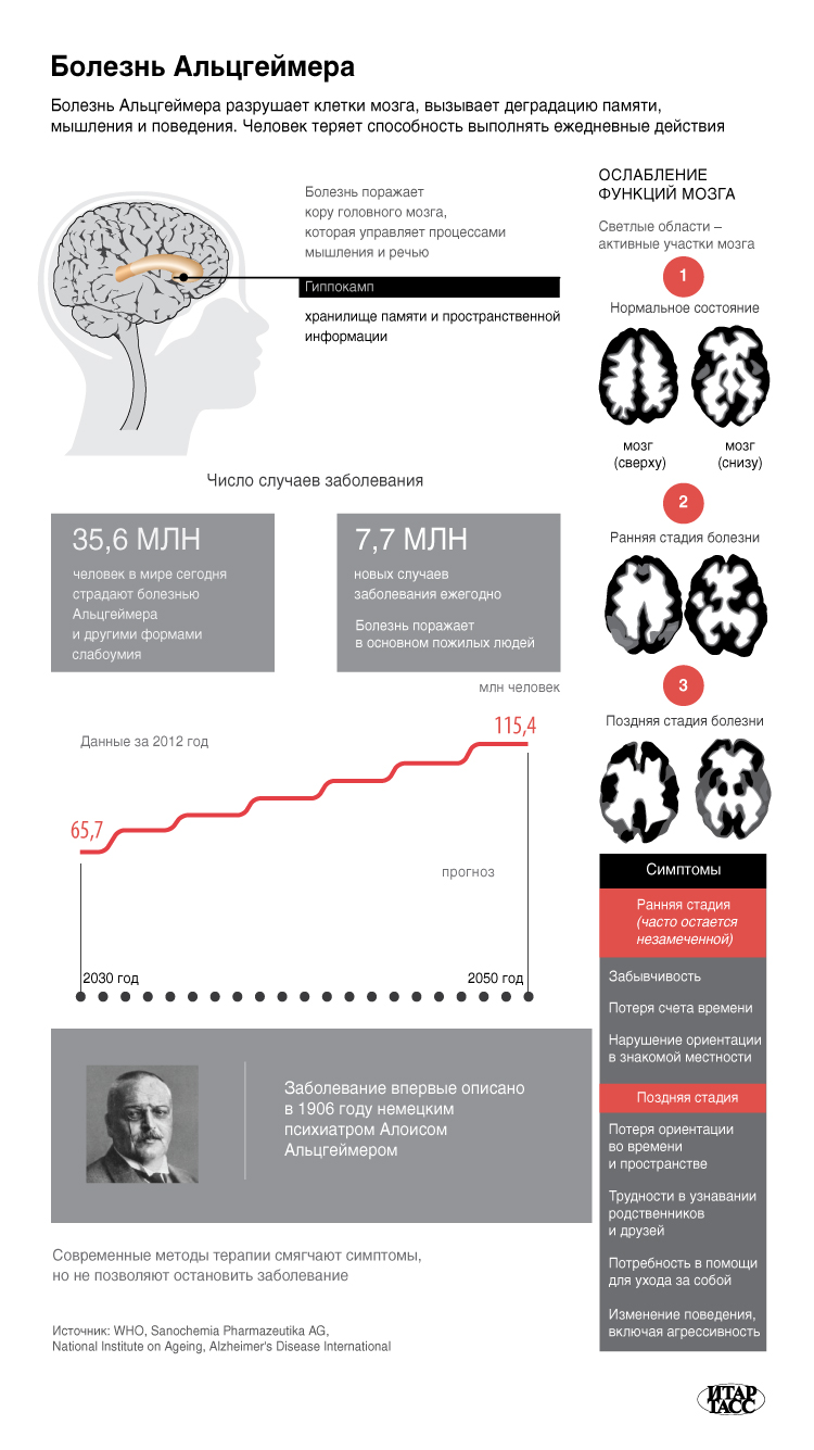 Болезнь Альцгеймера