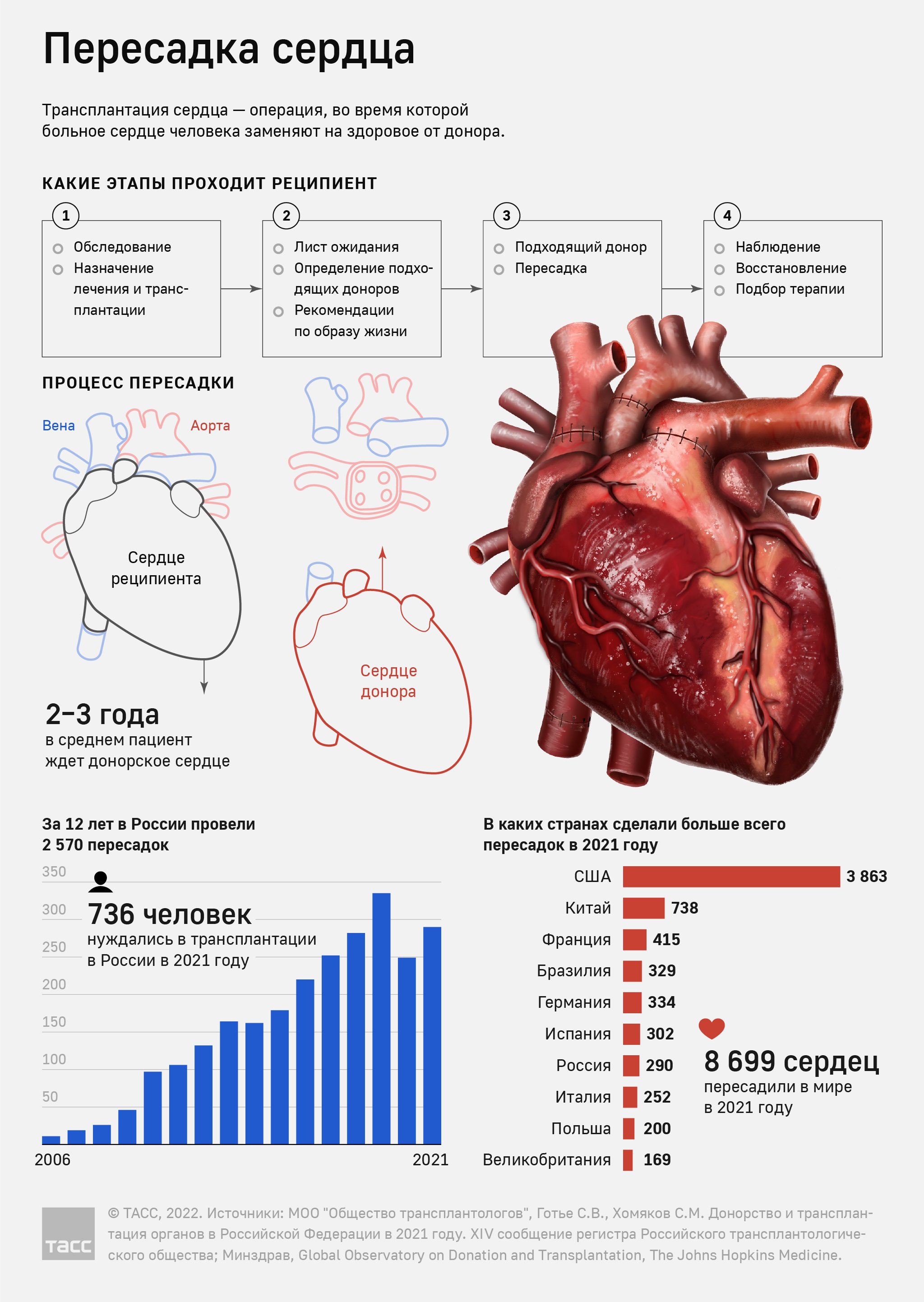 Трансплантация сердца в России и в мире